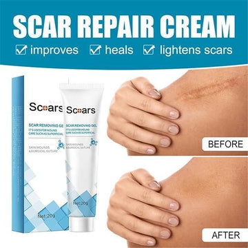 Scar Removing Gel 20gm (Pack of 1)